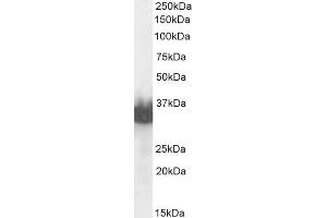 ABIN6391379 (0. (Prostate Specific Antigen Antikörper  (C-Term))