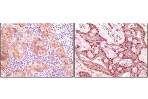 Immunohistochemistry (IHC) image for anti-Synuclein, gamma (Breast Cancer-Specific Protein 1) (SNCG) antibody (ABIN1107306)