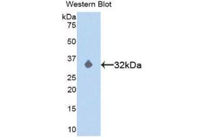 Western Blotting (WB) image for anti-Mitogen-Activated Protein Kinase Kinase 3 (MAP2K3) (AA 99-343) antibody (ABIN1859745) (MAP2K3 Antikörper  (AA 99-343))