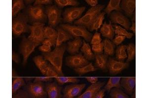 Immunofluorescence analysis of U-2 OS cells using NEXN Polyclonal Antibody at dilution of 1:100. (NEXN Antikörper)
