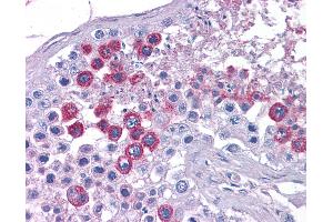 Anti-ATP11A antibody IHC of human testis. (ATP11A Antikörper  (N-Term))