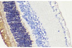 Immunohistochemistry of paraffin-embedded Mouse retina using RHO Polyclonal Antibody at dilution of 1:200 (40x lens). (Rho-related GTP-binding protein Antikörper)