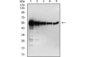 Western blot analysis using SARS-CoV-2-NP2 mAb against human SARS-CoV-2-N (AA: 1-419) recombinant protein. (SARS-Cov2-NP2 (AA 120-300) Antikörper)