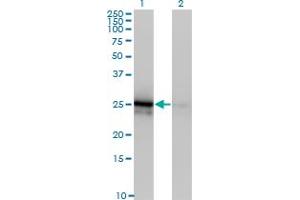 Western Blot analysis of FGF21 expression in transfected 293T cell line by FGF21 monoclonal antibody (M03), clone 3G10. (FGF21 Antikörper  (AA 30-209))