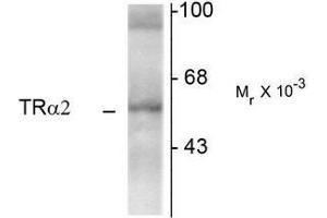 Western Blotting (WB) image for anti-Thyroid Hormone Receptor, alpha (THRA) (N-Term) antibody (ABIN371845) (THRA Antikörper  (N-Term))