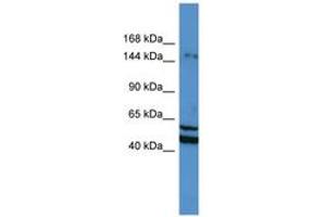 Image no. 1 for anti-Zinc Finger Protein 261 (ZMYM3) (N-Term) antibody (ABIN6746153) (ZMYM3 Antikörper  (N-Term))