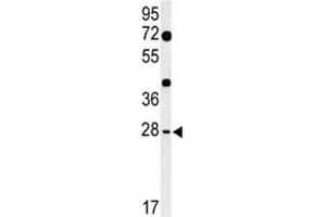 Western blot analysis of HES7 antibody and mouse heart tissue lysate. (HES7 Antikörper  (AA 26-55))