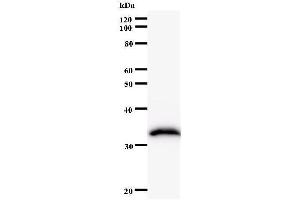 Western Blotting (WB) image for anti-FtsJ RNA Methyltransferase Homolog 2 (FTSJ2) antibody (ABIN931161)