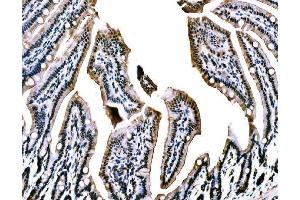 IHC analysis of WAPL/FOE using anti-WAPL/FOE antibody (ABIN7602663). (WAPAL Antikörper  (AA 916-1190))