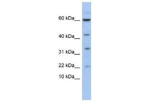 WB Suggested Anti-LMO2 Antibody Titration:  0. (LMO2 Antikörper  (N-Term))