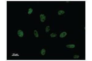 Immunostaining analysis in HeLa cells. (BCL3 Antikörper)