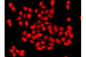 Immunofluorescence analysis of A549 cell using CAMK1D antibody. (CAMK1D Antikörper)