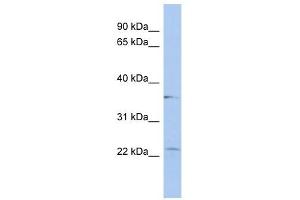 LYSMD2 antibody used at 1 ug/ml to detect target protein. (LYSMD2 Antikörper  (Middle Region))