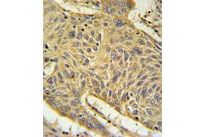 Immunohistochemistry (Paraffin-embedded Sections) (IHC (p)) image for anti-Advanced Glycosylation End Product-Specific Receptor (AGER) (AA 24-52), (N-Term) antibody (ABIN651054)