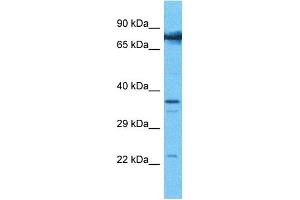 Host:  Rabbit  Target Name:  COMP  Sample Type:  786-0 Whole Cell lysates  Antibody Dilution:  1.