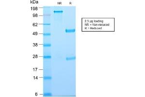 SDS-PAGE Analysis of Purified Thymidine Phosphorylase Rabbit Recombinant Monoclonal (TYMP/2890R). (Rekombinanter Thymidine Phosphorylase Antikörper)