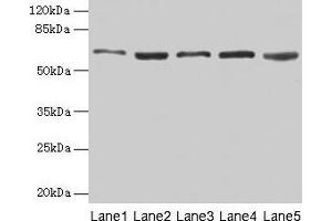 Western blot All lanes: STIP1 antibody at 12 μg/mL Lane 1: Hela whole cell lysate Lane 2: HepG2 whole cell lysate Lane 3: NIH/3T3 whole cell lysate Lane 4: Jurkat whole cell lysate Lane 5: Rat gonadal tissue Secondary Goat polyclonal to rabbit IgG at 1/10000 dilution Predicted band size: 63, 69, 60 kDa Observed band size: 63 kDa (STIP1 Antikörper  (AA 1-543))