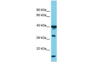 Host:  Rabbit  Target Name:  PCBP1  Sample Type:  MCF7 Whole Cell lysates  Antibody Dilution:  1.