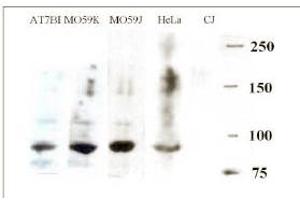 Western blotting with anti-ARTEMIS antibody ABIN117935 at a 1:500 dilution in various cell lysates. (DCLRE1C Antikörper  (AA 482-495))