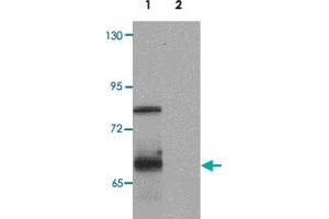 Western blot analysis of ORMDL1 in SK-N-SH Cell lysate with ORMDL1 polyclonal antibody  at 1 ug/mL (lane 1) and 2 ug/mL (lane 2). (ORMDL1 Antikörper)