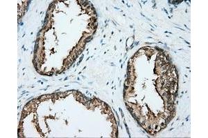 Immunohistochemical staining of paraffin-embedded liver tissue using anti-DNTTIP1 mouse monoclonal antibody. (DNTTIP1 Antikörper)