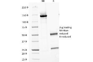 SDS-PAGE Analysis Purified MVP Monoclonal Antibody (Clone 1014). (MVP Antikörper)