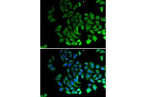 Immunofluorescence analysis of U2OS cells using PIWIL1 antibody (ABIN6293460). (PIWIL1 Antikörper)