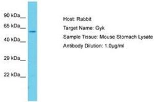 Image no. 1 for anti-Glycerol Kinase (GK) (AA 101-150) antibody (ABIN6750351) (Glycerol Kinase Antikörper  (AA 101-150))