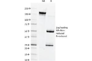 SDS-PAGE Analysis Purified Connexin 32 Mouse Monoclonal Antibody (Clone M12. (GJB1 Antikörper)