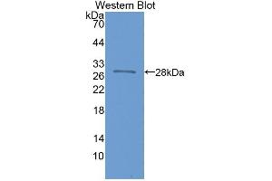 Detection of Recombinant NOS1AP, Human using Polyclonal Antibody to Nitric Oxide Synthase 1 Adaptor Protein (NOS1AP) (NOS1AP Antikörper  (AA 285-506))