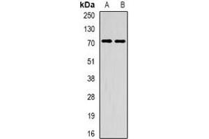Western blot analysis of METTL3 expression in HepG2 (A), mouse spleen (B) whole cell lysates. (METTL3 Antikörper)