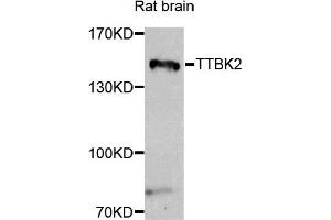 Western blot analysis of extracts of rat brain, using TTBK2 antibody. (TTBK2 Antikörper)