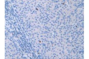 Figure. (ATF6 Antikörper  (AA 1-377))