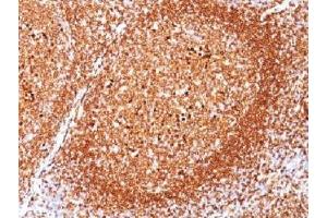 IHC testing of FFPE human tonsil stained with CD79a antibody (clone JCB117). (CD79a Antikörper  (AA 202-216))