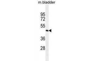 Western Blotting (WB) image for anti-Phosphatidic Acid Phosphatase Type 2 Domain Containing 1A (PPAPDC1A) antibody (ABIN2996072) (PPAPDC1A Antikörper)