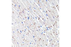 Immunohistochemistry of paraffin-embedded mouse heart using N-Cadherin Rabbit mAb (ABIN7265999) at dilution of 1:100 (40x lens). (N-Cadherin Antikörper)