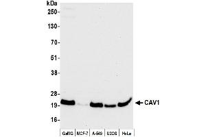 Western Blotting (WB) image for anti-Caveolin 1, Caveolae Protein, 22kDa (CAV1) (AA 1-50) antibody (ABIN7452652)