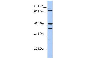 WB Suggested Anti-TGM5 Antibody Titration:  0.