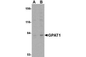 Western blot analysis of GPAT1 in rat brain tissue lysate with AP30375PU-N GPAT1 antibody at (A) 1 and (B) 2 μg/ml. (GPAM Antikörper  (C-Term))