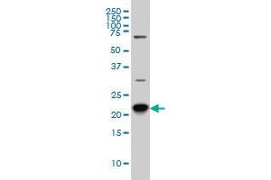 RAB8A monoclonal antibody (M02), clone 3G1 Western Blot analysis of RAB8A expression in Hela S3 NE . (RAB8A Antikörper  (AA 108-207))