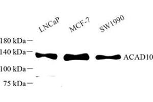 Western blot analysis of ACAD10 (ABIN7072924) at dilution of 1: 500 (ACAD10 Antikörper)