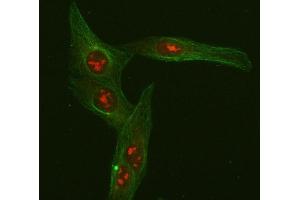 IF analysis of FOXO3A using anti-FOXO3A antibody (ABIN3042404) and anti-Beta Tubulin antibody (ABIN7602743). (FOXO3 Antikörper  (AA 471-673))