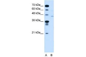 FKTN antibody used at 5 ug/ml to detect target protein. (Fukutin Antikörper  (N-Term))