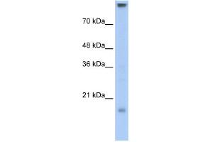 WB Suggested Anti-CLDN11 Antibody Titration:  0. (Claudin 11 Antikörper  (C-Term))
