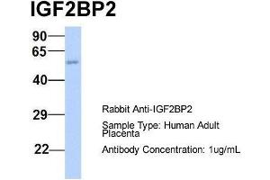 Host:  Rabbit  Target Name:  IGF2BP2  Sample Type:  Human Adult Placenta  Antibody Dilution:  1. (IGF2BP2 Antikörper  (Middle Region))