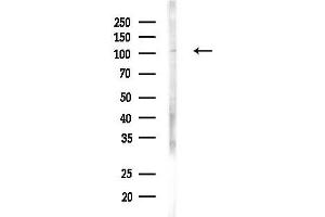 anti-Elongation Factor Tu GTP Binding Domain Containing 2 (EFTUD2) antibody