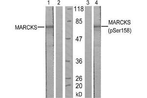 Western blot analysis of extract from starved NIH/3T3 cells, using MARCKS (Ab-158) antibody (E021285, Lane 1 and 2) and MARCKS (phospho-Ser158) antibody (E011293, Lane 3 and 4). (MARCKS Antikörper)