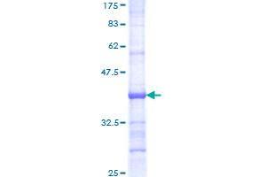 Image no. 1 for Bone Morphogenetic Protein 6 (BMP6) (AA 382-471) protein (GST tag) (ABIN1346769) (BMP6 Protein (AA 382-471) (GST tag))