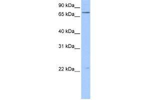 WB Suggested Anti-BFSP1 Antibody Titration:  0.