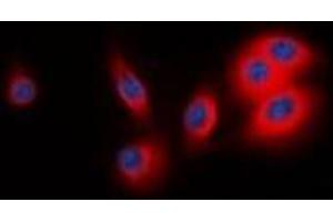 Immunofluorescent analysis of BCAR3 staining in MCF7 cells. (BCAR3 Antikörper  (C-Term))